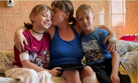 Mother and daughter were seriously injured in the russian missile attack on Kramatorsk train station in early April. 11-year-old Yana lost both legs. Mother Natalia has to continue on one leg.
